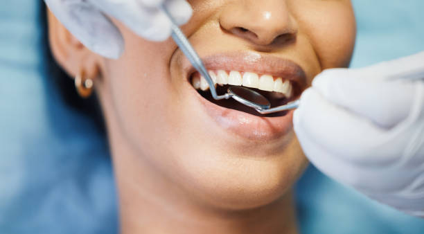 Best Emergency Broken Tooth Repair in Grandview, OH